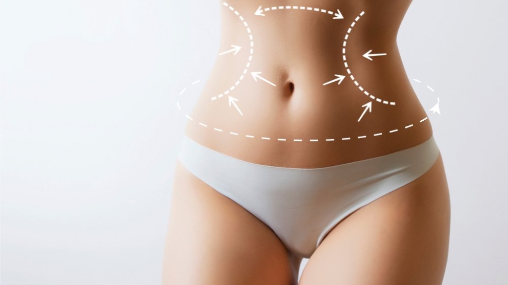 360 liposuction areas