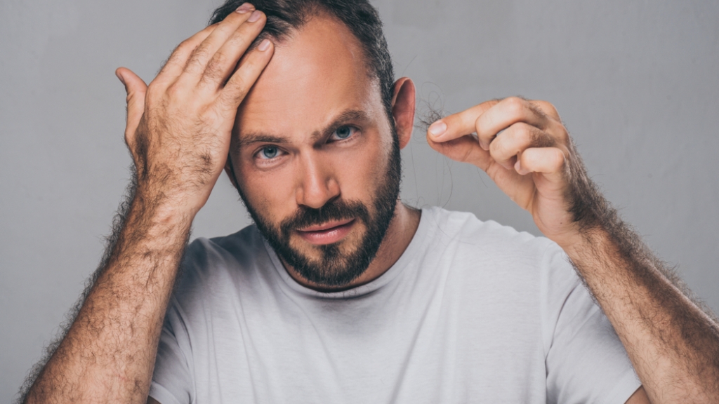 hair loss in men